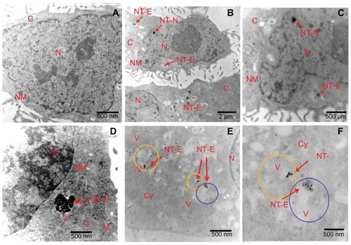 Figure 5 TEM images of Eu-SWCNT distributed in the cytoplasm and nucleus of SK-BR-3 cancer cells.Notes: TEM images of morphology of (A) untreated cells; (B) Eu-SWCNT-treated cells; distribution in the nucleus of Eu-SWCNT at (B) low magnification and (C) high magnification; (D) presence of Eu-SWCNT in cytoplasmic vacuoles; Eu-SWCNT-treated cells, showing their distribution in (E) lysosomes (yellow circles) and (F) endosomes (purple circles). Arrows point to Eu-SWCNT.Abbreviations: TEM, transmission electron microscopy; N, nucleus; NM, nuclear membrane; Cy, cytoplasm; V, vacuole; M, mitochondria; ST-N, Eu-SWNT in nucleus; NT-E, endocytosed Eu-SWNT.