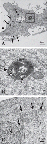 Figure 1 Electron microscopy shows that fibroblasts in co-culture display increased autophagy and MCF7 cells exhibit abundant mitochondria. To monitor the status of autophagy, hTERT-fibroblasts and MCF7 cells were co-cultured for three days, fixed and evaluated by electron microscopy. (A and B) Co-cultured fibroblasts display numerous lysosomes and autophagosomes. (A) The EM image represents a fibroblast with numerous lysosomes (arrows) and autophagosomes (boxed area). (B) The higher magnification of the boxed area depicts an autophagosome. Note that the autophagosome shows (i) a double-membrane (arrowhead) and (ii) organelles within that appear to be degraded mitochondria (arrows). Bars = 1 µm for (A); = 0.2 µm for (B). (C) Co-cultured MCF7 cells exhibit the presence of many mitochondria. Note that co-cultured MCF7 cells exhibit the presence of many mitochondria (arrows) and of intermediate keratin filaments (demonstrating their epithelial origin). N, nucleus.