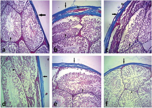 Figure 8. A photomicrograph of Masson Trichrome-stained sections of testes of the different groups.