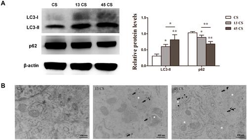 Figure 4 Effects of 13-nm and 45-nm AuNPs on autophagy of PDLSC sheets. (A) Western blot of LC3, p62, and quantification. (B) TEM images; arrows indicate internalized AuNPs, and the white “*”Indicates autophagosomes. *p<0.05, **p<0.01.