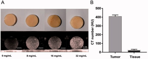 Figure 4. US and CT images of the disc-shaped phantom samples (with about 3 cm diameter) that were sliced from the spherical tumor phantom. (A) The ultrasound images (Philip EPIQ7, 7.5 MHz linear array probe) are depicted for four different psyllium husk concentration. (B) The CT number of tumor phantom sample was compared with that of normal tissue phantom sample (SAMATOM Force, 40 mA 120 kV).