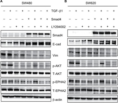 Figure 6 SMAD4 reexpression modulates E-cad and Vim expression by AKT–EPHA2 signal pathways.Notes: (A) Restoration of SMAD4 results in a marked decrease of Vim by inhibiting p-AKT and p-EPHA2, but significantly increased the E-cad by AKT–EPHA2 pathways in colon cancer SW480 cells. (B) Restoration of SMAD4 results in the same phenomenon in colon cancer SW620 cells. Total protein extracted from indicated cells were lysed for WB analysis. WBs were then performed with the indicated antibodies. β-Actin served as an internal control.Abbreviations: E-cad, E-cadherin; Vim, Vimentin; WB, Western blot.