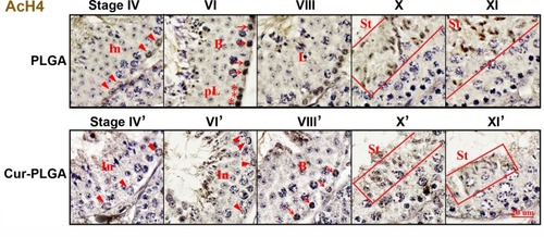 Figure 7 Inhibition on acetylated histone 4 expression by Cur-PLGA-NPs treatment. In (arrowhead), intermediate spermatogonia; B (arrow), B type spermatogonia; pL (asterisk), preleptotene spermatocytes; L, leptotene spermatocytes; St, elongating spermatids. Bars=20 μm.