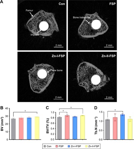 Figure 9 Micro-CT analysis of each group.Notes: (A) Micro-CT images of femurs 8 weeks after implantation. New bone with a high-density structure was observed around the implant. (B–D) Analysis of the BV, BV/TV, and Tb.N around the implant (within 2 mm from the implant); *P<0.05.Abbreviations: BV, bone volume; micro-CT, microcomputed tomography; Con, control group; FSP, friction stir processing; Tb.N, trabecular number; TV, total volume; Zn, zinc.