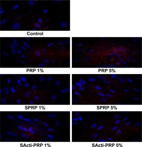 Figure 5 The effect of different concentrations of PRP, SPRP, and SActi-PRP on expression and translocation of ERK1/2 in human skin fibroblasts.