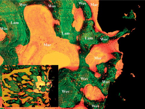 Figure 3. Characteristic histomorphometry of treated implant with no fibrous tissue and increased bone-implant contact. Note also the increased new bone formation along with increased allograft resorption. Wov: woven bone; Lam: lamellar bone; Fib: fibrous tissue, Mar: marrow space.