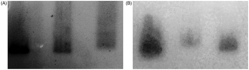 Figure 2. Analysis of purified P252A and P226A beta-lactamase mutants and wild-type beta-lactamase; (A) native gel stained with Coomassie Brilliant Blue G-250 and (B) zymogram of the native gel.