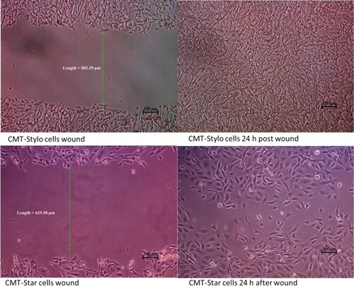 Figure 5. Wound induced migration assay. The wound was induced on the cells using sterile 200 µL pipette tips. The width of the wound created on CMT-Stylo cells was 502.19 µm, while that of CMT-Star cells was 625.58 µm. By 24 h, both wounds are almost completely closed up by the cells.