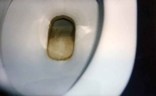 Photo 7. Photo taken by a young female showing a dirty toilet