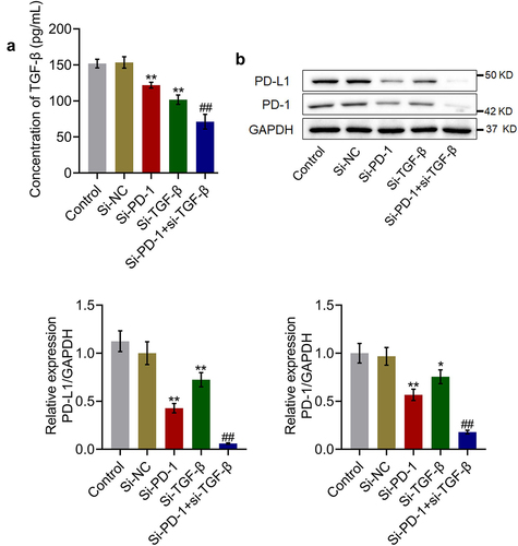 Figure 2. TGF-β and PD-1/PD-L1 expression was suppressed by si-PD-1 and si-TGF-β. RFA was performed on the co-culture of H22 and CD8+ T cells, followed by transfection with si-NC, si-PD-1, si-TGF-β, and si-PD-1 + si-TGF-β. A. The secretion of TGF-β was measured by ELISA. B. The expression levels of PD-1 and PD-L1 were determined by western blotting (*p < 0.05 vs. si-NC, **p < 0.01 vs. si-NC, ##p < 0.01 vs. si-PD-1).