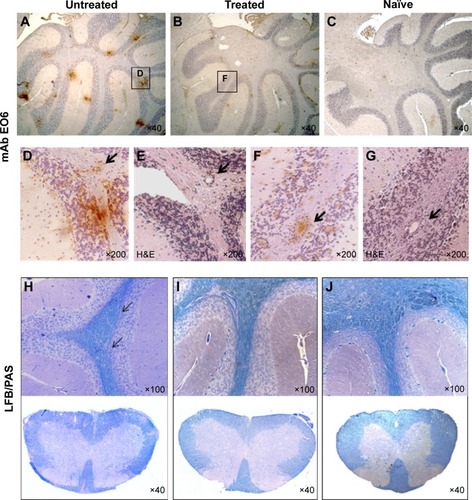 Figure 6 Pathological markers of EAE in Nano-PSO treated and untreated mice.Notes: Nano-PSO treated and untreated mice were sacrificed 3 weeks after induction of EAE, and their formalin-fixed, paraffin-embedded brain sections as well as those of age-matched naïve mice (C and J) were stained by mAb EO6 (A–D and F), H&E (E and G), and LFB/PAS (brains and spinal cords) (H–J). (D) and (F) represent an enlargement of the squares in (A) and (B); (E) and (G) are serial sections of (D) and (F), respectively. Arrows in (D–G) indicate immune infiltrates. Arrows in (H) represent demyelinated areas.Abbreviations: EAE, experimental autoimmune encephalomyelitis; PSO, pomegranate seed oil; mAb, monoclonal antibody; H&E, hematoxylin and eosin; LFB, Luxol fast blue; PAS, periodic acid Schiff.