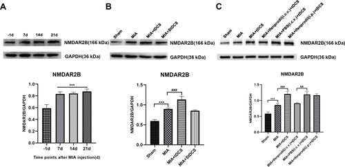 Figure 2 (A) Effect of MIA on NMDAR2B protein in the PAG by Western blot analysis. Data were presented as the mean ± SEM (n= 3/group). ***P<0.001, represented comparison of 7 days, 14 days and 21 days after MIA injection with 1 day before MIA injection. (B) The expression of NMDAR2B protein in the PAG was measured at 14 days after tDCS treatment. Data were presented as the mean ± SEM (n=3/group). ***P<0.001, MIA group vs Sham group; ###P<0.001, MIA+tDCS group vs MIA group. (C) The expression of NMDAR2B protein in the PAG was measured at 14 days after tDCS treatment. Data were presented as the mean ± SEM (n=3/group). ***P<0.001, MIA group vs Sham group; ###P<0.001, MIA+tDCS group vs MIA group; &&P<0.01, MIA+PBS (i.c.v.)+tDCS vs MIA+Ifenprodil (i.c.v.)+tDCS group.