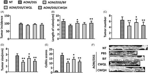 Figure 1. Chang-wei-qing ameliorated colitis-associated tumour development in mouse model. (A) Tumour incidence. (B) Length of colon. (C) Tumour number. (D) Tumour size. (E) Colitis severity scores. (F) Representative histopathological images. NT: none treated, control group; AOM/DSS: treated with AOM, DSS and PBS, colitis-associated cancer group; AOM/DSS/Bif: treated with AOM, DSS and Bifico; AOM/DSS/CWQL: treated with AOM, DSS and low dose Chang-wei-qing; AOM/DSS/CWQH: treated with AOM, DSS and high dose Chang-wei-qing. Data are means ± SD (n = 6 for each group). Experiments were repeated for three times. *p < 0.05, **p < 0.01 vs. AOM/DSS group.