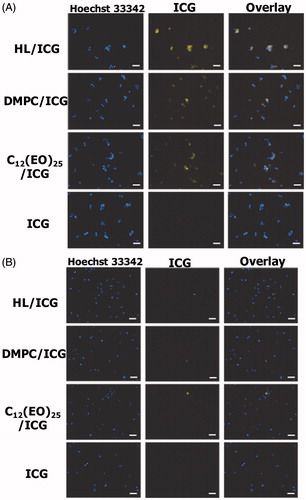 Figure 5. (A) Fluorescence micrographs of HCT116 cells after treatment with HL/ICG for 3 h. (B) Fluorescence micrographs of normal colon cells after treatment with HL/ICG for 3 h. Scale bar: 50 μm.