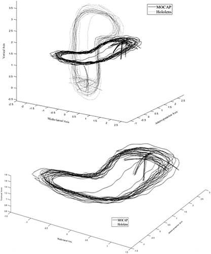 Figure 1. 3D Representation of headset trajectory with Hololens and VICON tracking for Trial 1 before ICP (top), and after ICP (bottom).