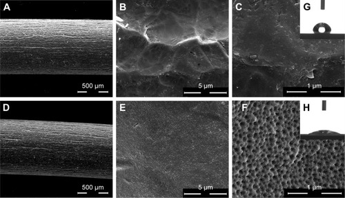Figure 2 The SEM micrographs of the titanium samples at different magnifications.Notes: (A–C) Untreated implant; (D–F) TiO2 nanoporous implant; (G) static contact angle on untreated implant samples; (H) static contact angle on TiO2 nanoporous implant samples.Abbreviation: SEM, scanning electron microscopy.