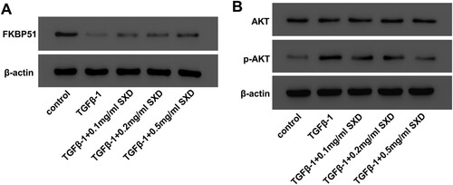 Figure 4. SXD attenuated TGF-β1-mediated FKBP51 expression and AKT phosphorylation. Cells were pretreated with different concentrations of SXD (0.1, 0.2 and 0.5 mg/mL) for 6 h, and then treated with 10 ng/mL TGF-β1 for 24 h. The protein levels of FKBP51, AKT, p-AKT were measured by western blotting. Data are expressed as mean ± SD (n = 3). SXD, Six-ingredient-Xiao-qing-long decoction.