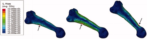 Figure 3. Results from three points of running stance, left to right: maximum braking, maximum vertical GRF, maximum propulsive force. Arrows represent points of maximum stress at each time point.