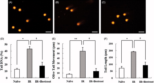 Figure 3. The effect of beetroot on DNA damage caused by γ-ray irradiation in splenocytes, as measured with the alkaline comet assay. Splenocytes were isolated from mice of each experiment group 10 days after 7 Gy WBI. Data shown are representative of three independent experiments. (a) Naive group, (b) IR group, (c) IR + Beetroot group, (d) percentage of tail DNA, (e) olive tail movement, (f) tail length in each group, scored according to the Komet 5.5 program. Bars in (a)–(c) represent 30 μm. Each criteria was calculated in 100 cells per mouse. Data are expressed as mean ± SEM (*, †p < .05, **p < .01).