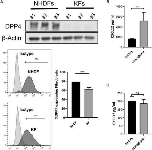 Figure 2 Inhibition of DPP4 increased extracellular CXCL12 without inducing CXCL12 expression. (A) Western blot and flow cytometry analyses of DPP4 in normal human dermal fibroblasts (NHDF) (n=3) and keloid-derived fibroblasts (KFs) (n=3). (B) ELISA analyses of CXCL12 in the culture supernatant of NHDFs (n=3) after inhibition of DPP4 activity. (C) ELISA analyses of CXCL12 in cell lysate of NHDFs (n=3) after linagliptin treatment (10nM). ns= P>0.05, ***P < 0.001.