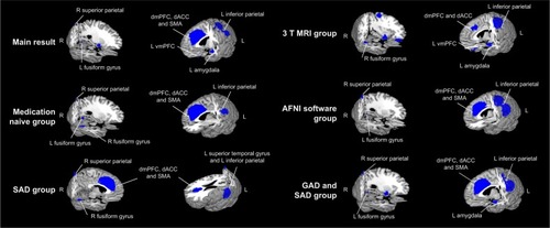 Figure 2 Regions of decreased (blue) activation in individuals with anxiety disorder compared with HC during cognitive reappraisal and subgroup analysis of medication naive group, 3 T MRI group, AFNI software group, SAD group and GAD and SAD group.