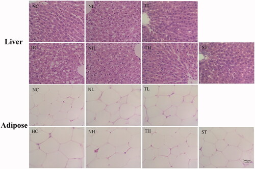 Figure 4. Effects of different extracts on histopathologic changes in the liver and adipose tissue of hyperlipidaemic rats. Original magnification 400 × and HE staining.