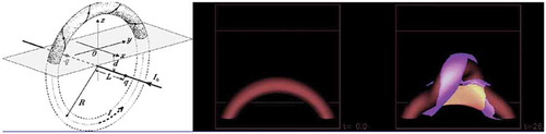 Figure 31. Simulation set up and kinking of the magnetic flux rope in solar flare. Modeling of the flux rope and development of the kink instability using ideal MHD code with the β = 0 plasma is given. The flux rope (half torus) is induced by the current under the chromosphere and the rope has driven current for the kink. This is quite similar to the case of kink instability demonstrated in sawtooth instability without boundary.Source: Titov, V. S., Démoulin, P., Astron. Astrophys. 351, 707, 1999