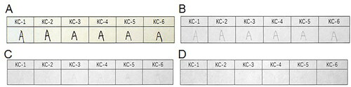 Figure 7. Changes in six types of erasable gel ink on printing paper obtained under infrared (IR) illumination conditions using continuous interference band-pass filters. (A) Original diagram under visible light. (B–D) IR absorption diagram at 645, 695 and 715 nm.